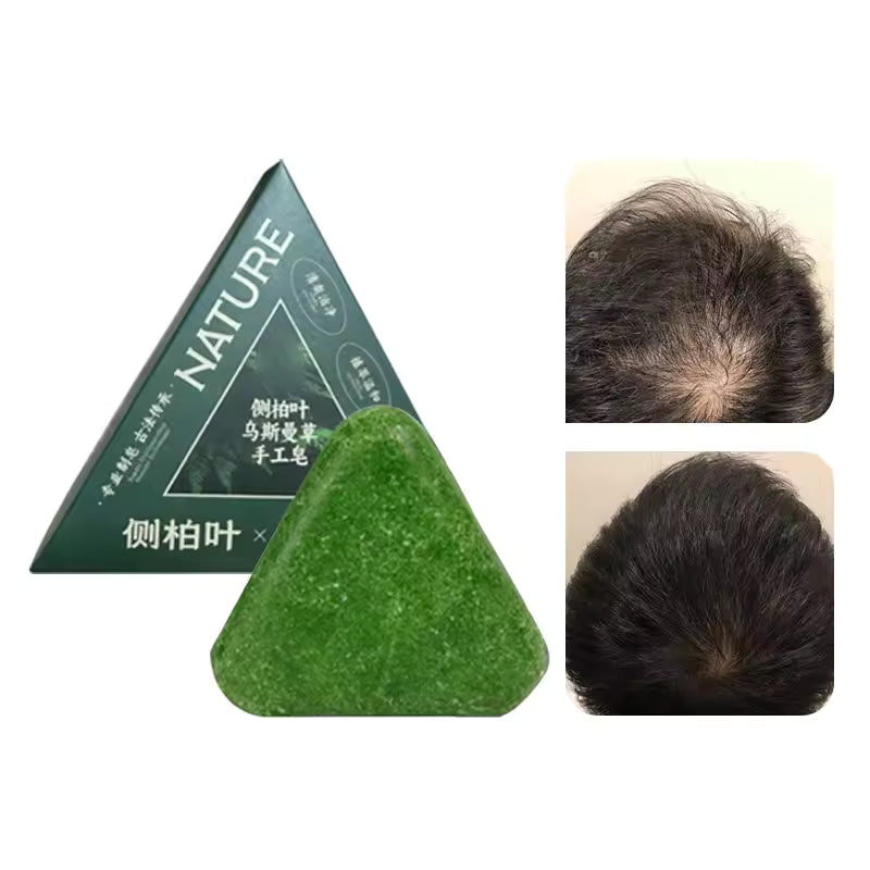 High Quality Green Nature Soaps for Clean & Healthy Skin
